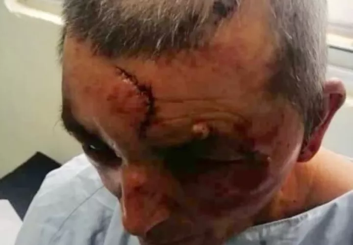 Luego de golpear brutalmente a la pareja en la cabeza y rostro se llevaron aproximadamente unos $5,000, prendas y el vehículo tipo camioneta propiedad de la pareja.