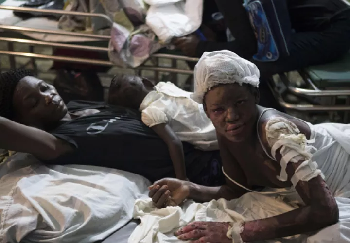 Muchos de los heridos están recibiendo atención en las afueras de este hospital, cuyo responsable de la unidad de urgencia, Rubén Pierre, reconoció en declaraciones Las limitaciones del centro para dar asistencia a los heridos. FOTO/AP