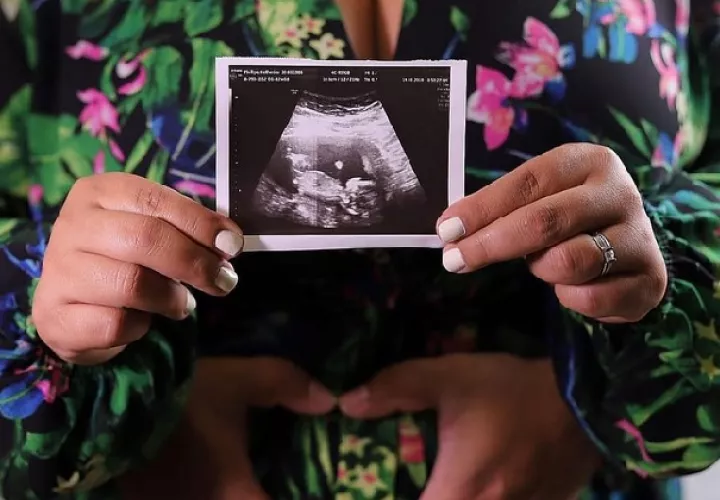 En ese entonces Kathy se encontraba en un tratamiento para lograr concebir y dijo: 'Si yo tengo que subir de peso y perder una figura esbelta para ser mamá, lo voy hacer'. 