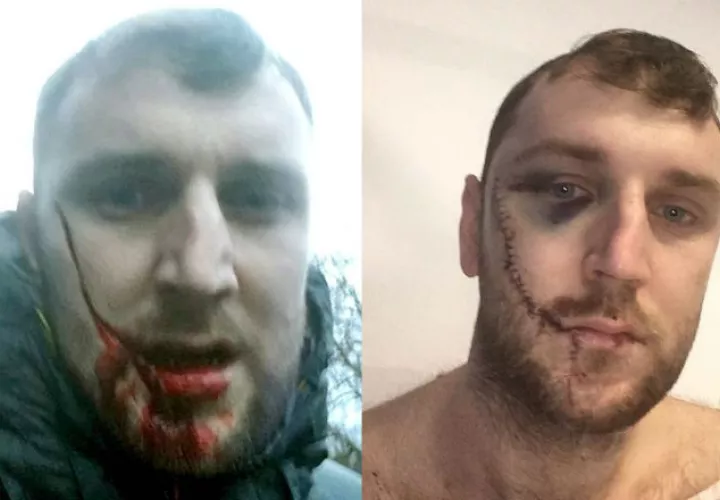 Así quedó el rostro de Jay Burns