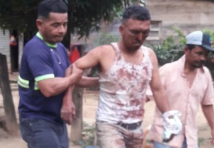 El macheteado (centro) también fue brutalmente golpeado. Foto: Mayra Madrid. 
