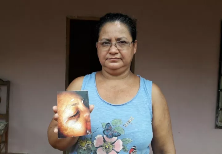 Doris Cazasola, quien fue su primera víctima hace cinco años, narró como fue atacada por este sujeto, cuando se bajó del bus en la parada, en ese momento sintió que el sujeto la golpeó, ella trató de defenderse. Foto/Mayra Madrid