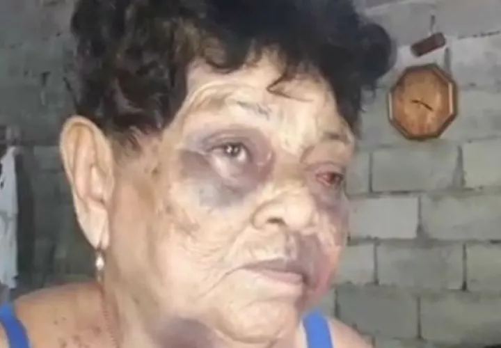 Ernestina Justavino Gutiérrez, de 88 años de edad, fue brutalmente golpeada por este sujeto. Foto: Mayra Madrid.