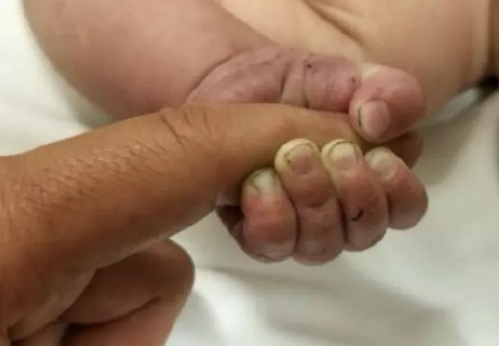 Los familiares de un recién nacido de forma prematura tienen el derecho de conocer el estado de salud del paciente. Foto: Panamá América