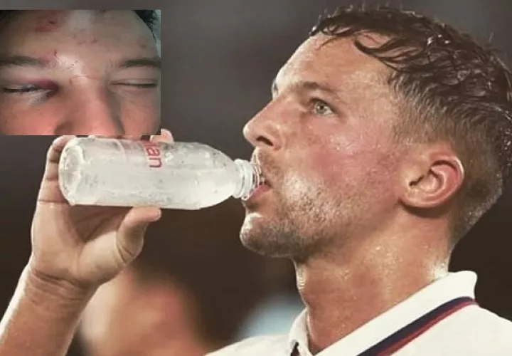 Danny Drinkwater está lesionado.
