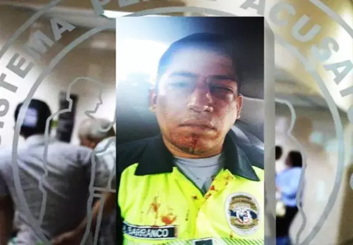 La unidad policial fue agredida por un conductor de un bus "pirata".