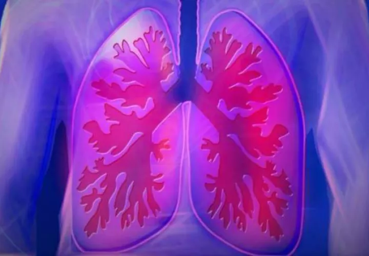 Por la salud de los pulmones. Foto: PIxabay