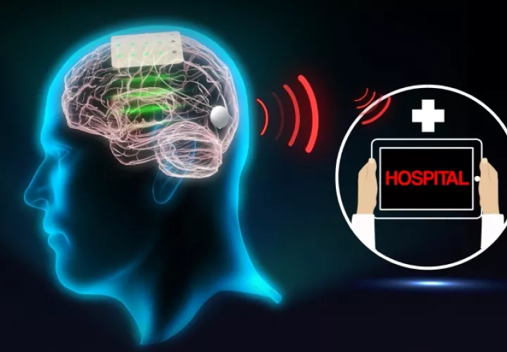 Infografía de cómo funciona un sensor interfaz cerebro-máquina. Fotos: EFE