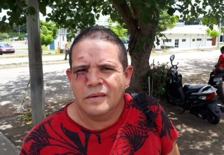 Magdaleno Almengor de 46 años, quien salió del Hospital Regional en David luego de permanecer por nueve días recluido debido a las heridas que sufrió, pidió una investigación objetiva. Foto/Mayra Madrid