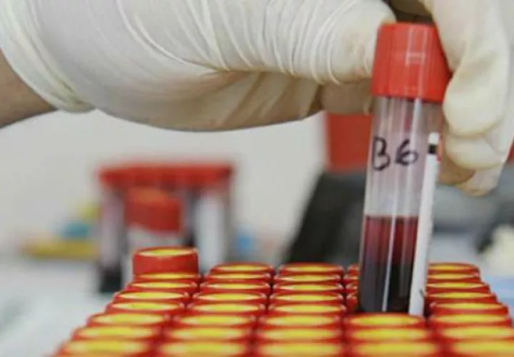 Personal sanitario examina pruebas de VIH. Foto: EFE