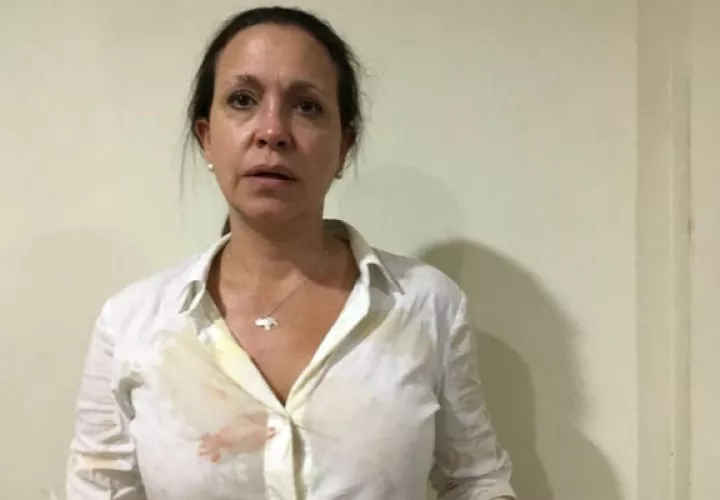 Machado tras el ataque que ha sufrido en Puerto Ordaz. Foto: EFE.