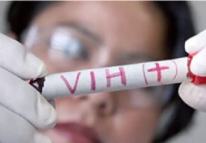 El trasplante se considera un hito para pacientes con el virus del Sida. Foto: Archivo/Ilustrativa. 