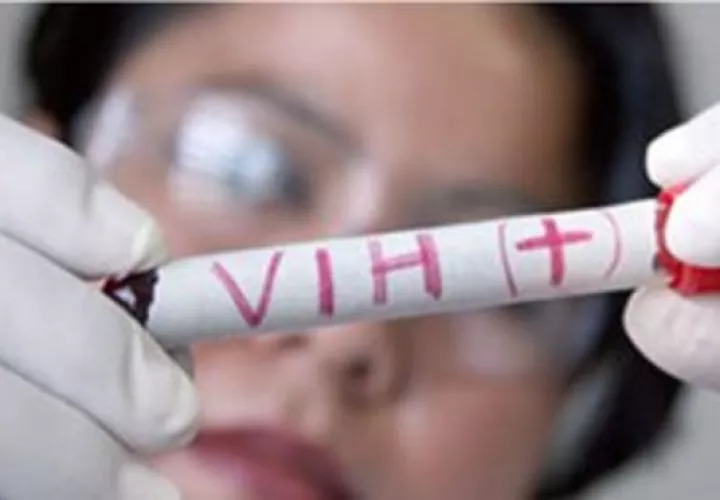 El descubrimiento permite conocer más sobre el VIH. Foto. Archivo/Ilustrativa. 