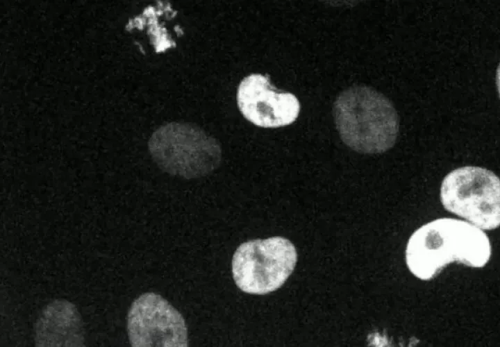 Medicinas que atacan unos genes en células cancerosas podrían errar con otros. Foto/ A. Lin et al., Science Translational Medicine, 2019.